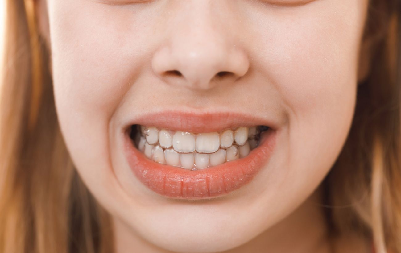 Фото новини