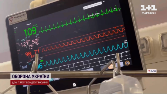 Вперше в Україні одну печінку розділили на двох хворих: як у Львові 15-річний донор врятував 5 життів