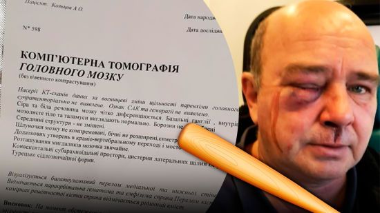 Новий скандал з ТЦК: під Києвом далекобійника жорстоко побили на очах у дружини – всі деталі