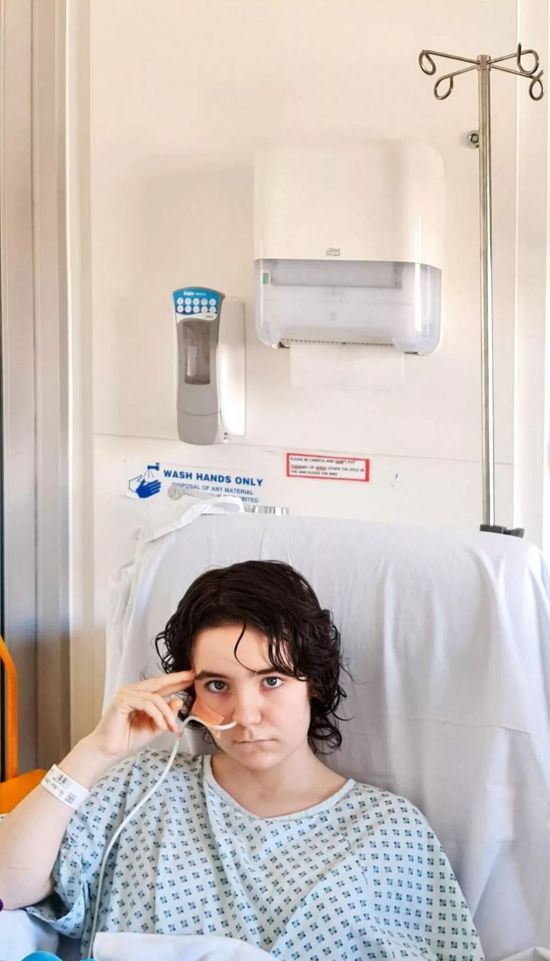 15-річній дівчинці із синдромом Рапунцель видалили зі шлунка 3 кг волосся – фото